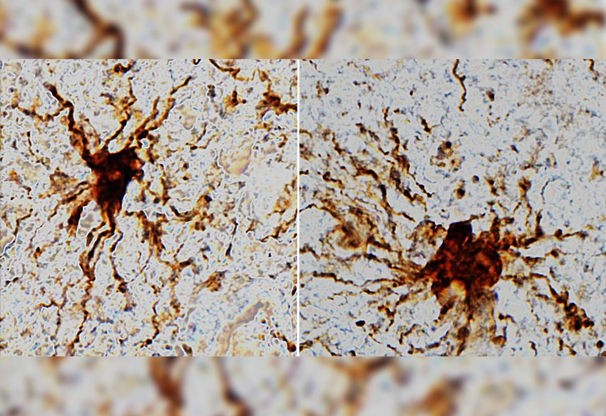 Neurolodzy wykryli komórki “zombie”, które ożywają w mózgu po śmierci człowieka