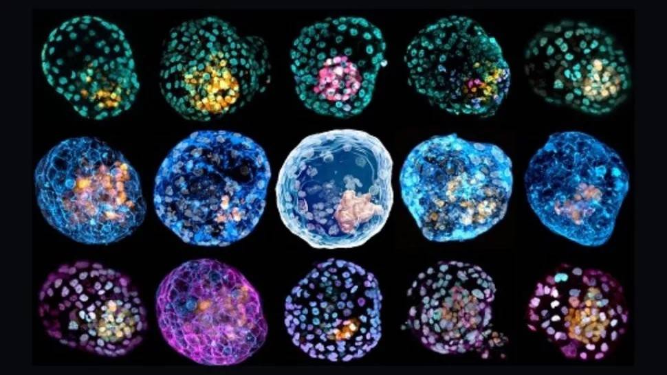 Stworzono „pierwsze kompletne modele” ludzkiego embrionu. Odkrycie budzi obawy etyczne
