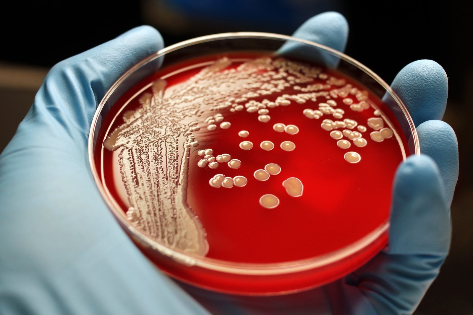 Kolistyna dziurawi bakterie. Naukowcy wiedzą, jak ulepszyć ten antybiotyk