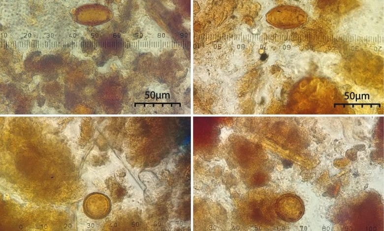 Przebadano 200-letnie ludzkie odchody. „Stan opieki medycznej był fatalny”