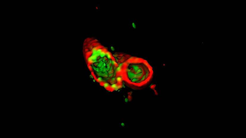 na-wybarwionym-zdjeciu-mikroskopowym-widac-jak-bialko-apol3-kolor-zielony-rozpuszcza-blone-komorkowa-bakterii-salmonella-kolor-czerwony-fot-r-gaudet-et-al-science-2021