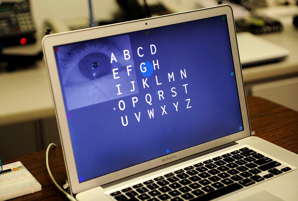 Interfejs mózg-komputer czyta w myślach i pomaga „mówić” sparaliżowanym