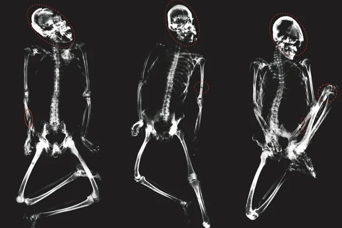 Zmasakrowane szczątki sprzed 3 tys. lat odkryto na pustyni Atakama. Tak starożytni walczyli o ziemię