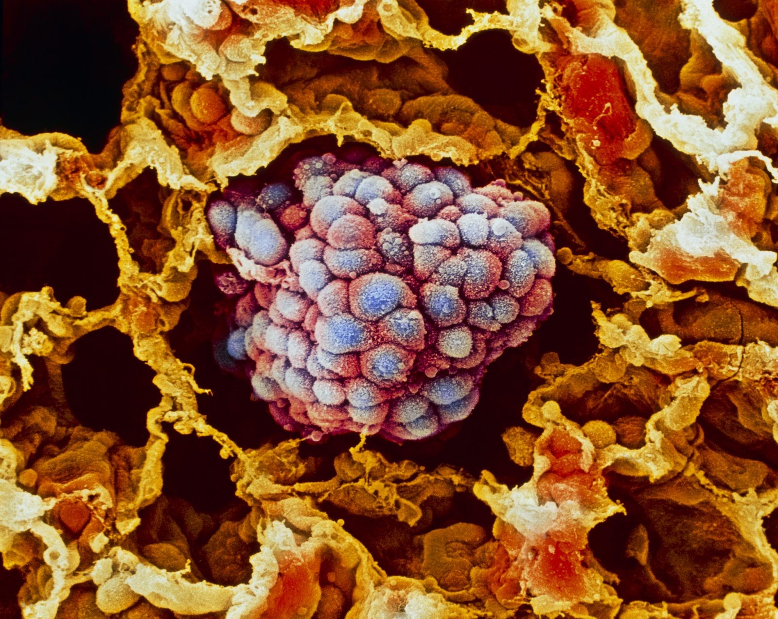 Komórki trzymają się swojego miejsca dzięki mikroskopijnym kotwicom. Badania nad nimi pomogą leczyć raka