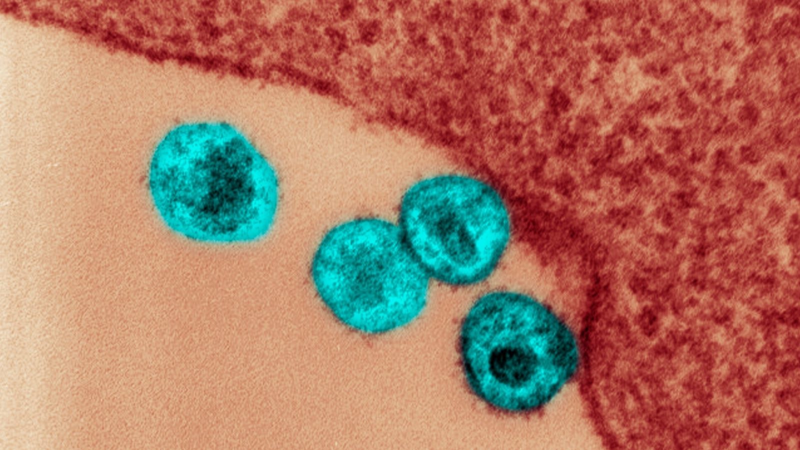 Wirus HIV