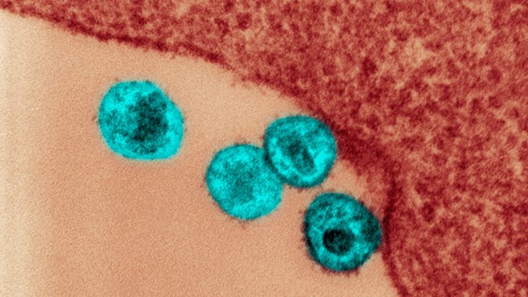 Czwarty w historii pacjent wyleczony z HIV. To “złożona i niebezpieczna metoda”