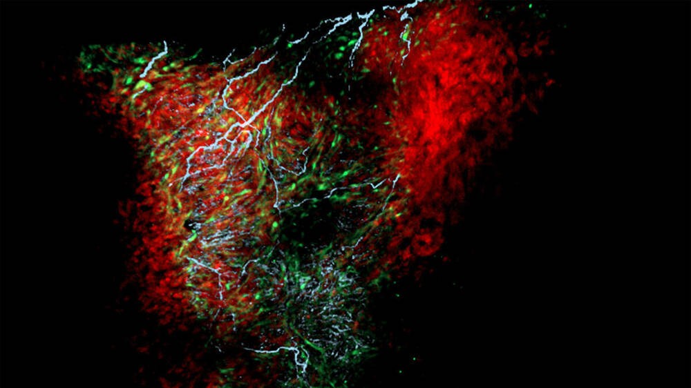 Naukowcy odkryli w sercu nowe komórki. Odpowiadają za rytm pracy serca i są podobne do tych w mózgu