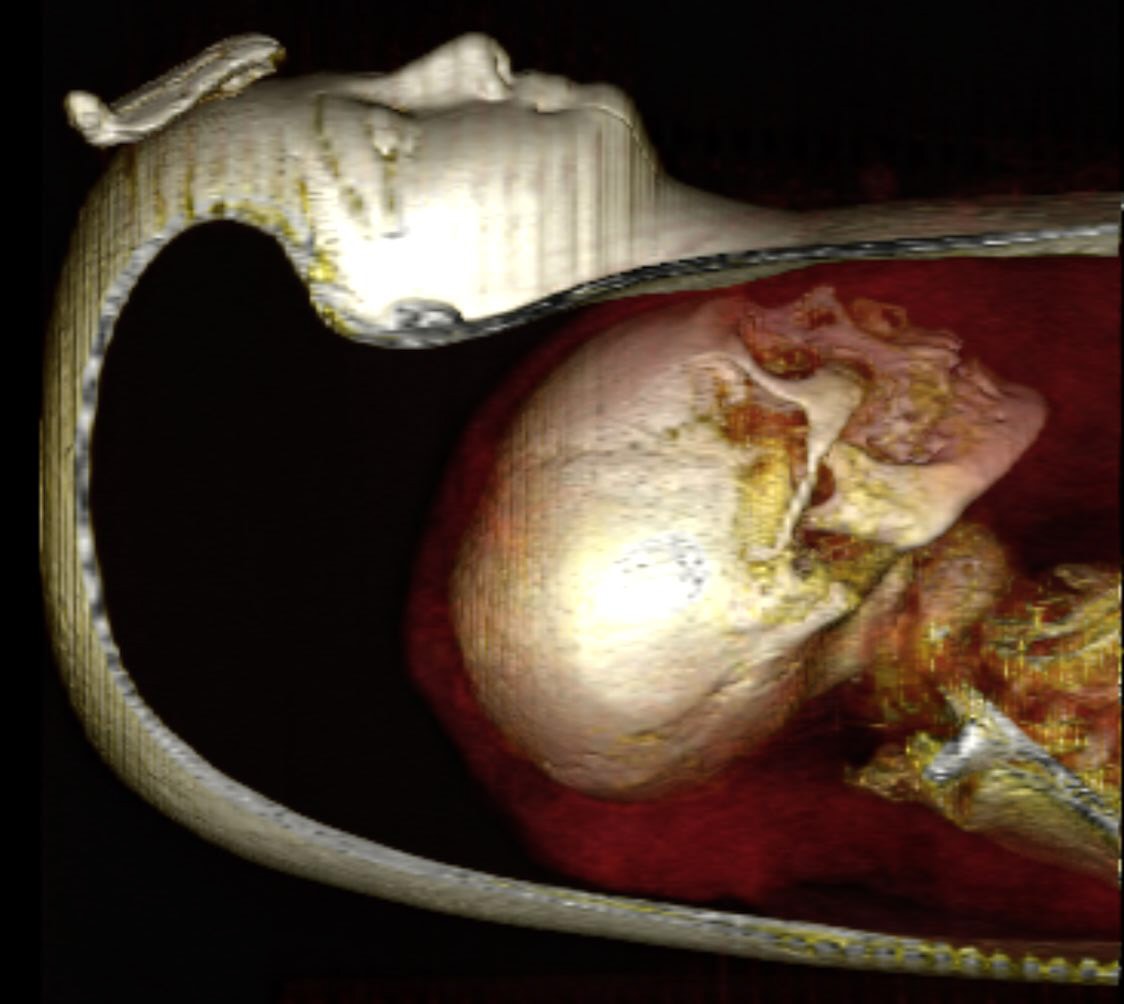 Naukowcy “rozpakowali” mumię faraona, nie niszcząc jej. Pomogła cyfrowa technologia