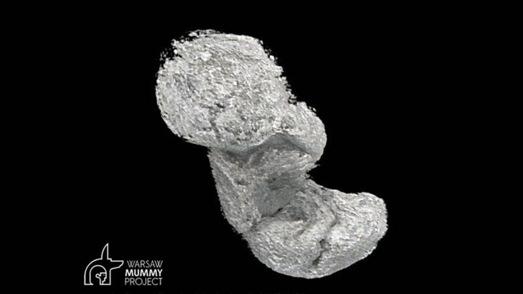 Płód mumii przetrwał 2000 lat, bo został “ukiszony” – twierdzą naukowcy z Warsaw Mummy Project