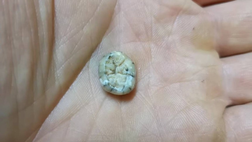 Tajemnicze znalezisko w Laosie. Do kogo należał ten ząb?