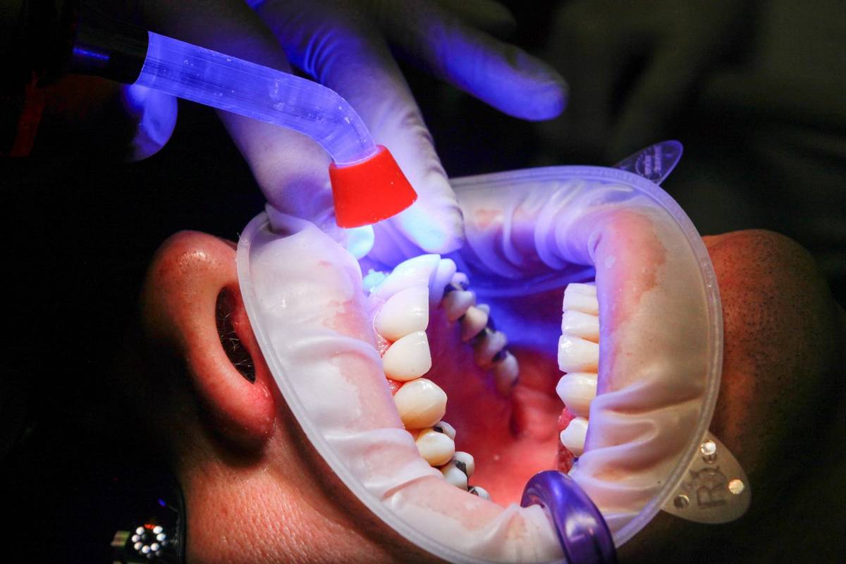 Nadchodzi przełom w leczeniu zębów? /Fot. Pixabay
