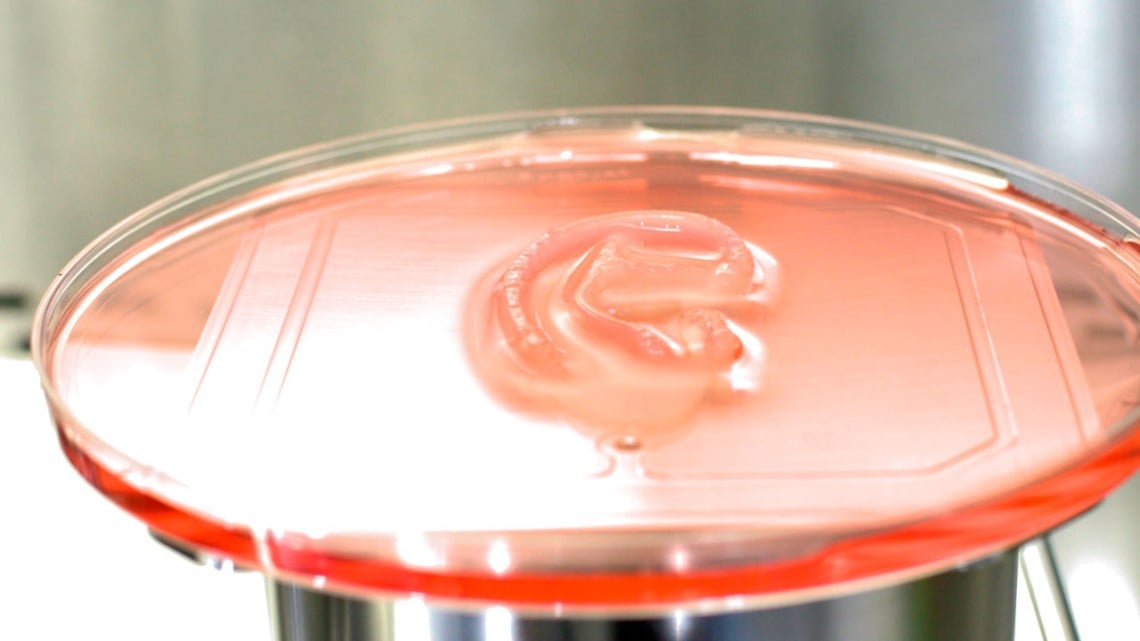 Wielki triumf bioinżynierii! Ucho z drukarki 3D przeszczepione pierwszej pacjentce