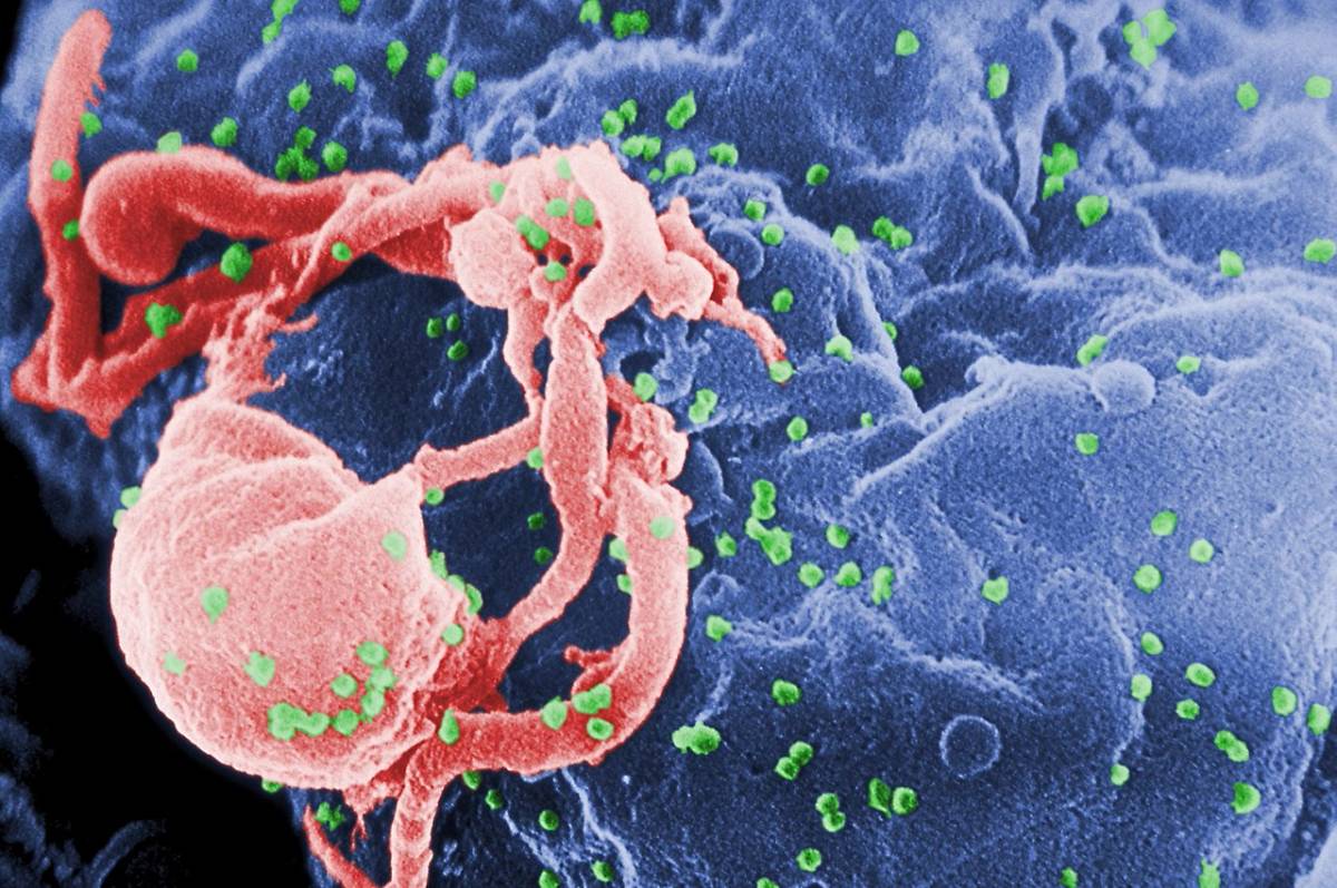 Wirus HIV-1 (na zielono) atakujący limfocyt /Fot. Wikipedia
